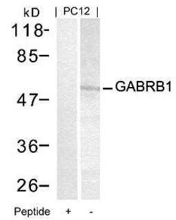 Western blot analysis of lysed extracts from PC12 cells using GABRB1 (Ab-434).