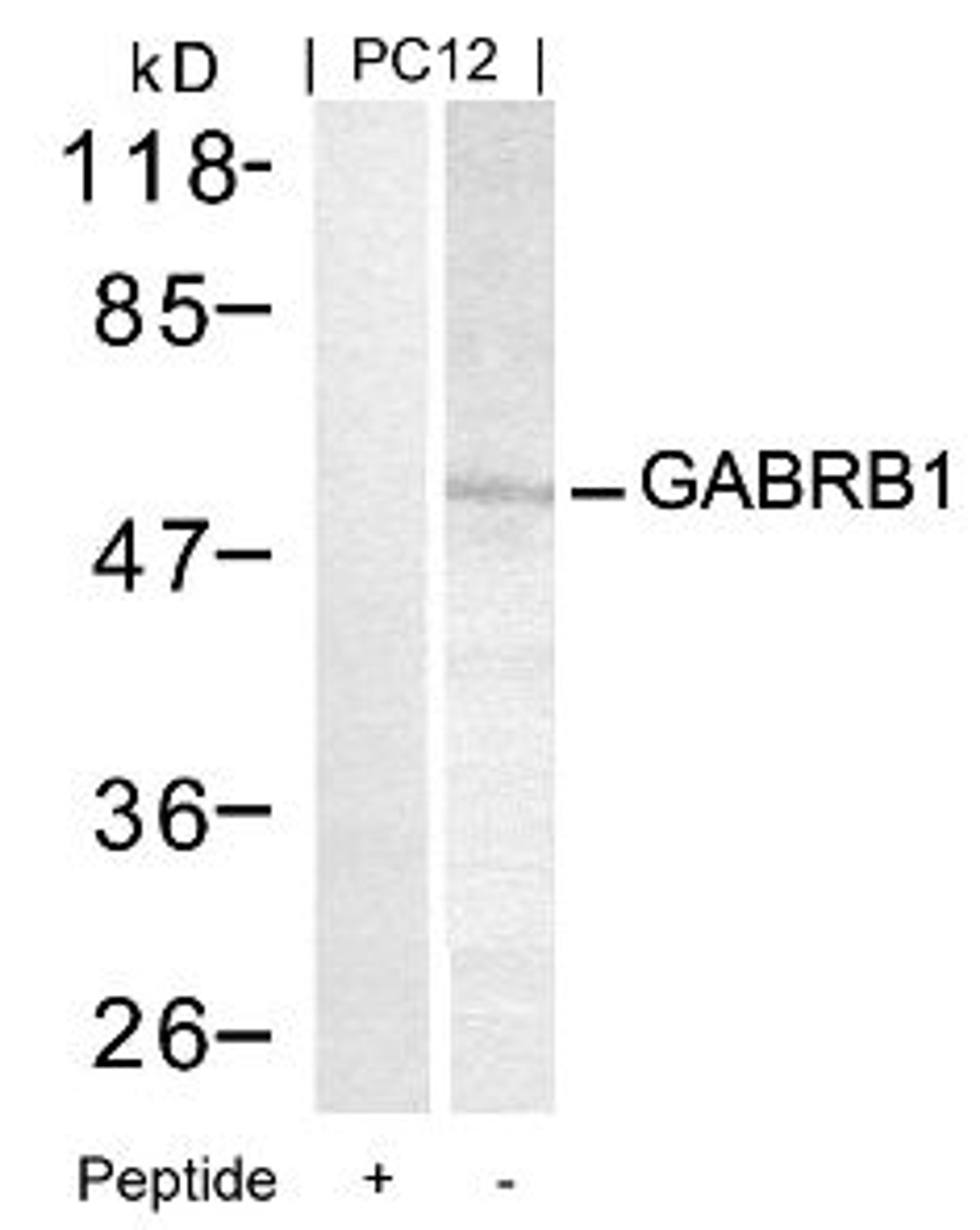 Western blot analysis of lysed extracts from PC12 cells using GABRB1 (Ab-434).