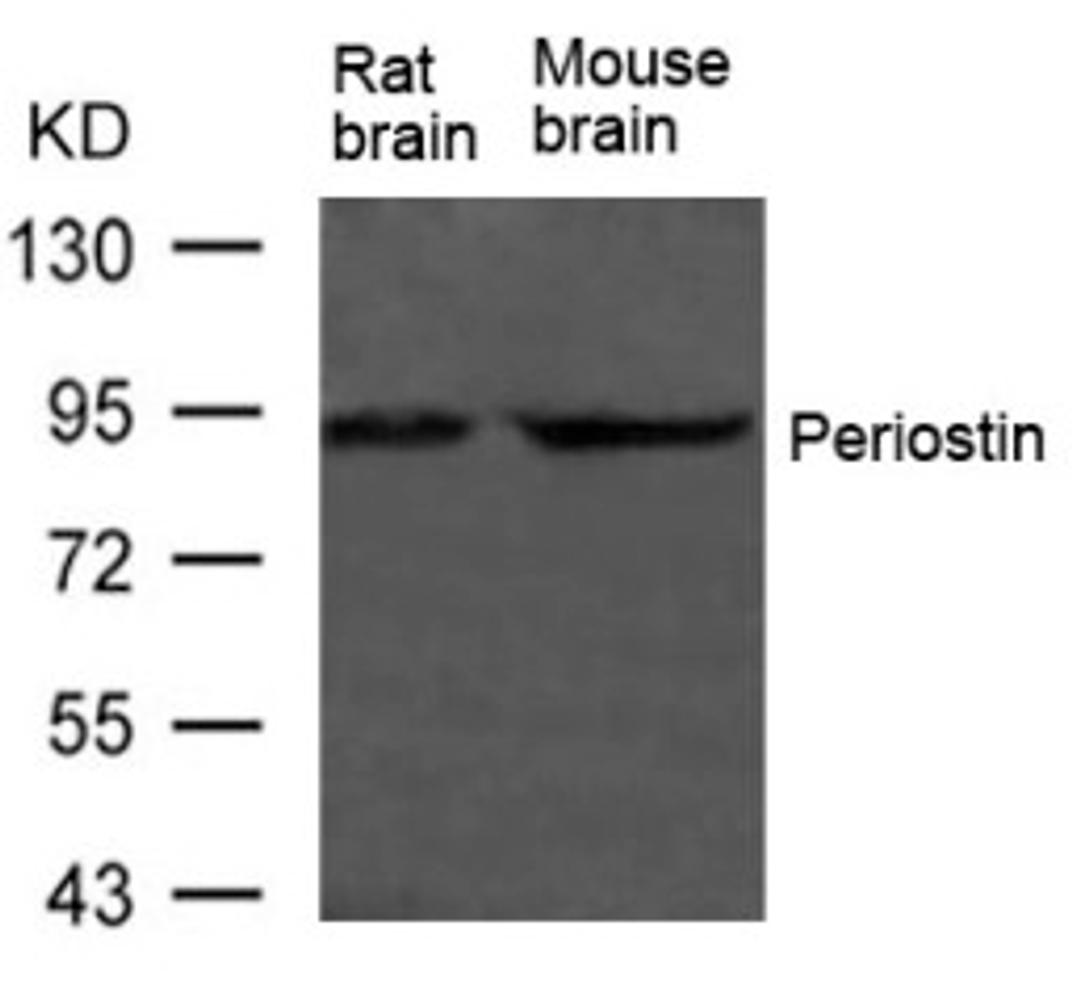 Western blot analysis of extract from Rat brain and Mouse brain Tissue using Periostin Antibody.