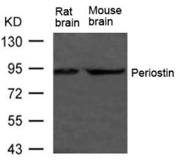 Western blot analysis of extract from Rat brain and Mouse brain Tissue using Periostin Antibody.