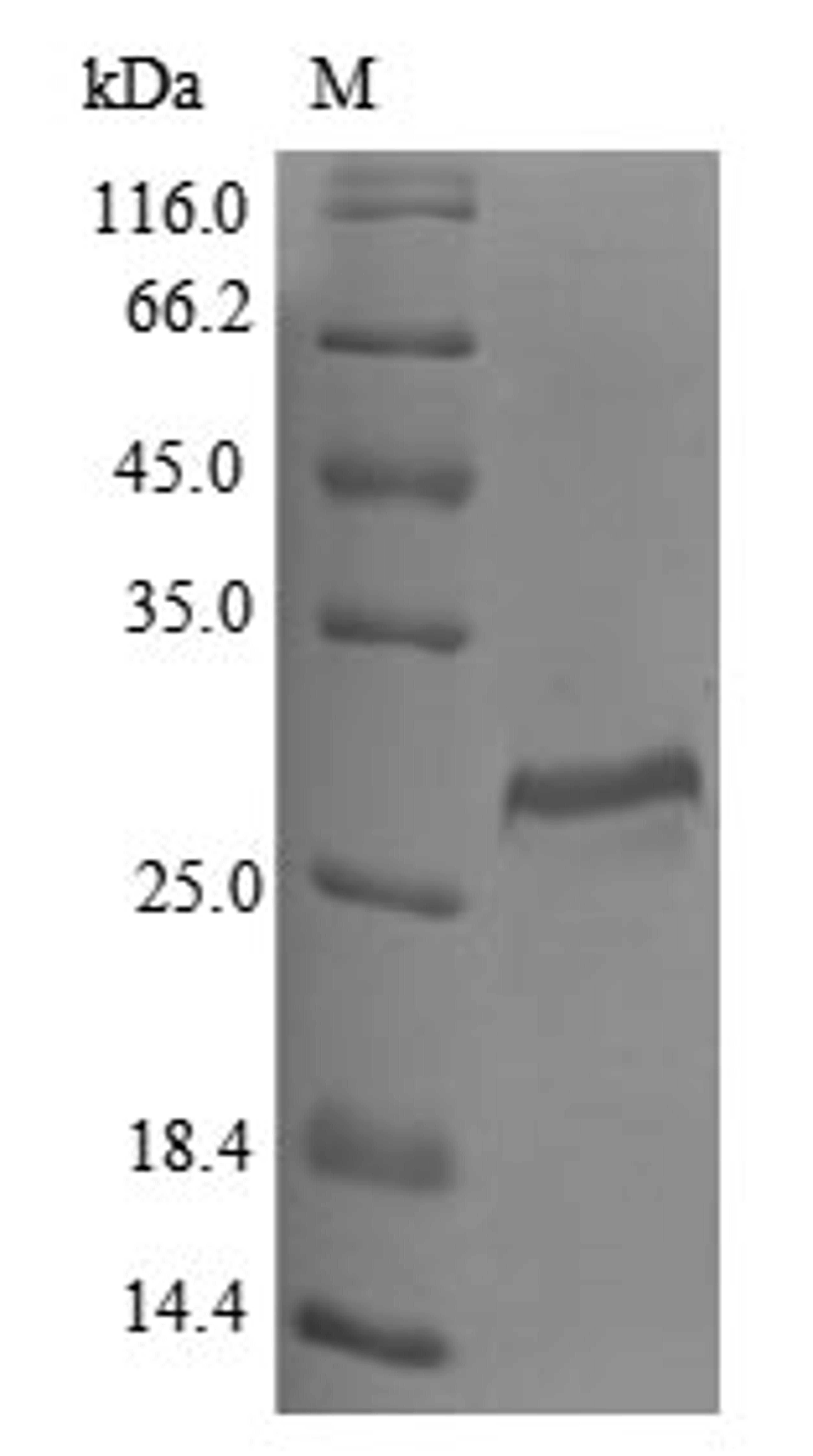 (Tris-Glycine gel) Discontinuous SDS-PAGE (reduced) with 5% enrichment gel and 15% separation gel.