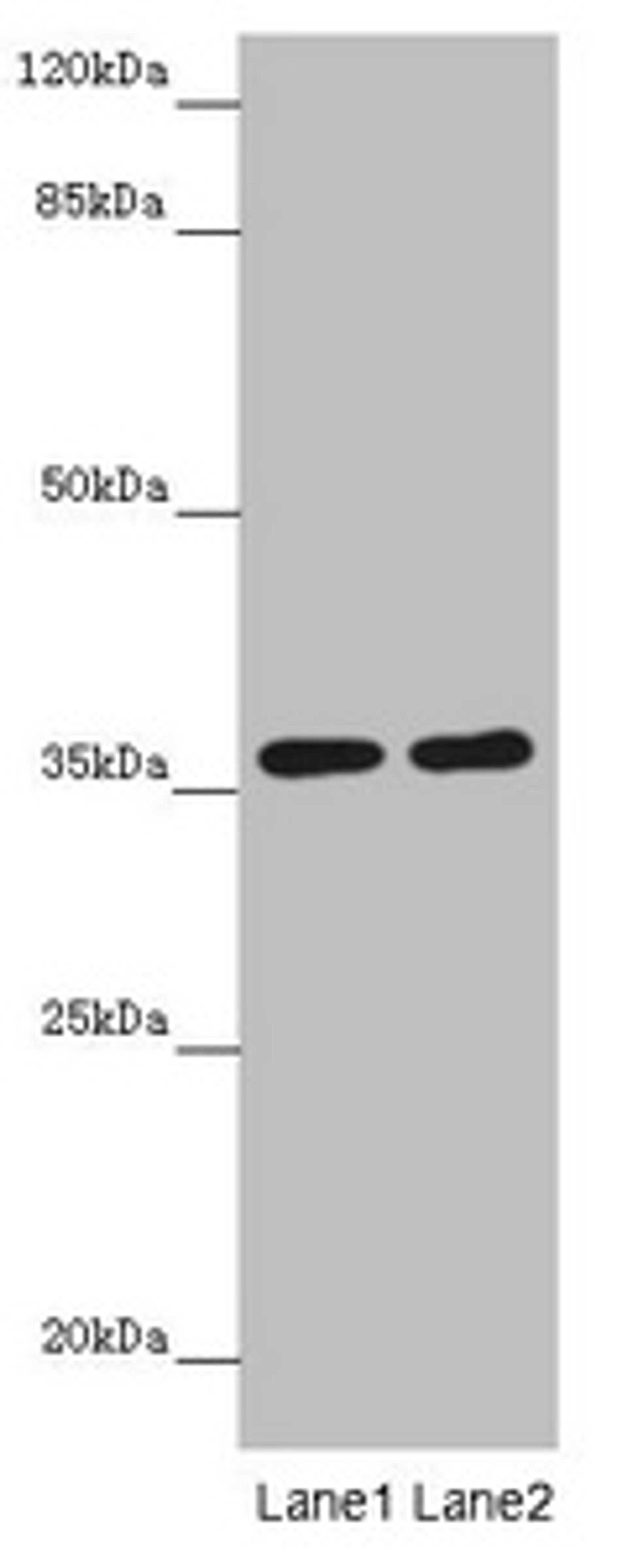 Western blot. All lanes: GNB1L antibody at 3.69µg/ml. Lane 1: Mouse brain tissue. Lane 2: Jurkat whole cell lysate. Secondary. Goat polyclonal to rabbit IgG at 1/10000 dilution. Predicted band size: 36, 23 kDa. Observed band size: 36 kDa