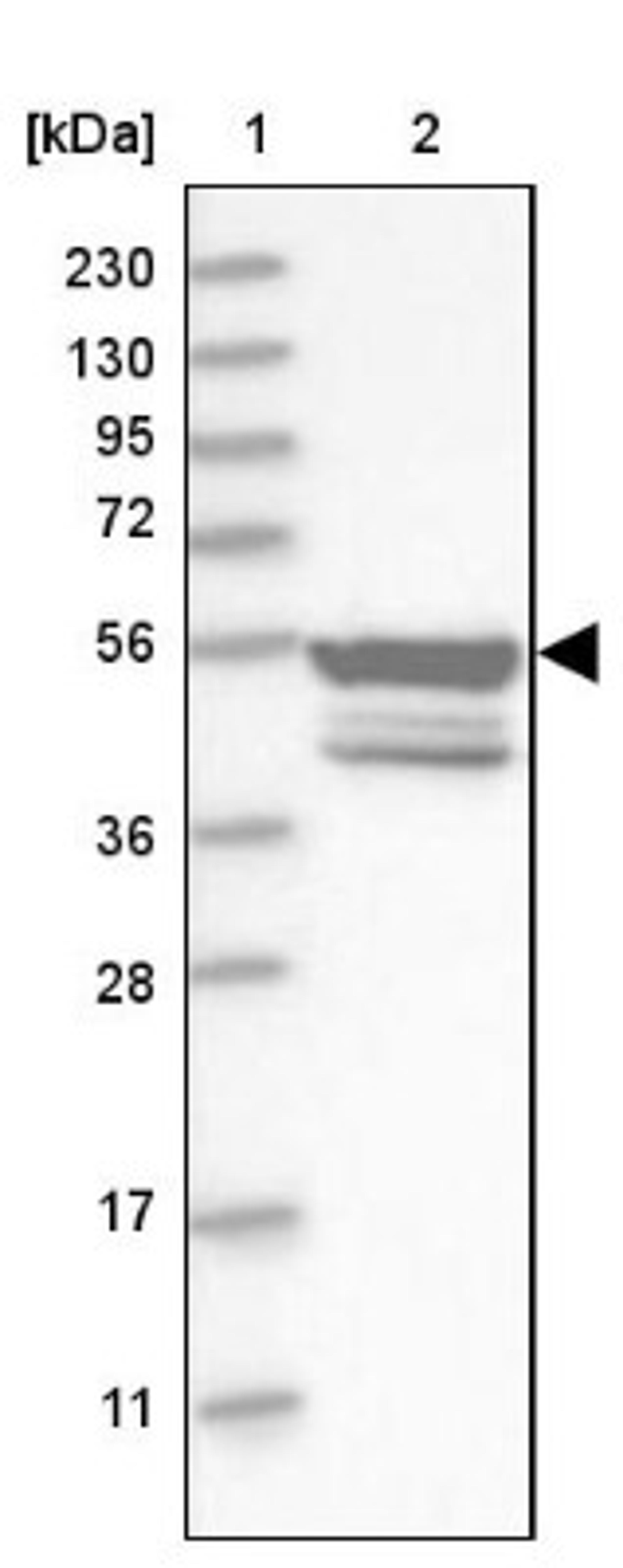 Western Blot: EYA2 Antibody [NBP1-84026] - Lane 1: Marker [kDa] 230, 130, 95, 72, 56, 36, 28, 17, 11<br/>Lane 2: Human cell line RT-4