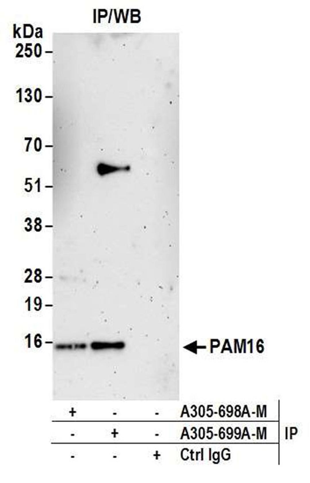 Detection of human PAM16 by WB of IP.