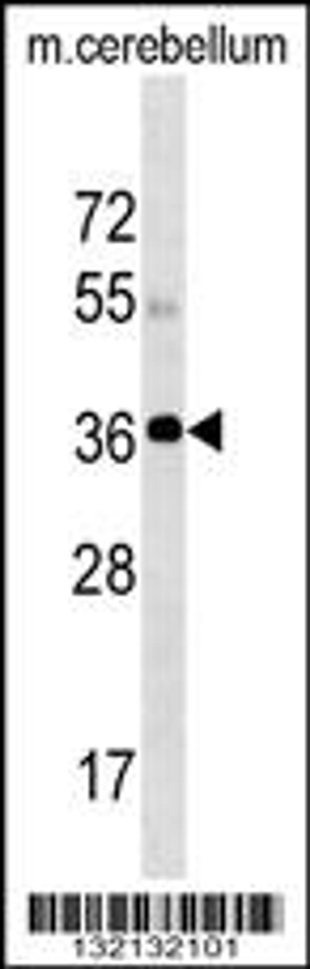 Western blot analysis in mouse cerebellum tissue lysates (35ug/lane).