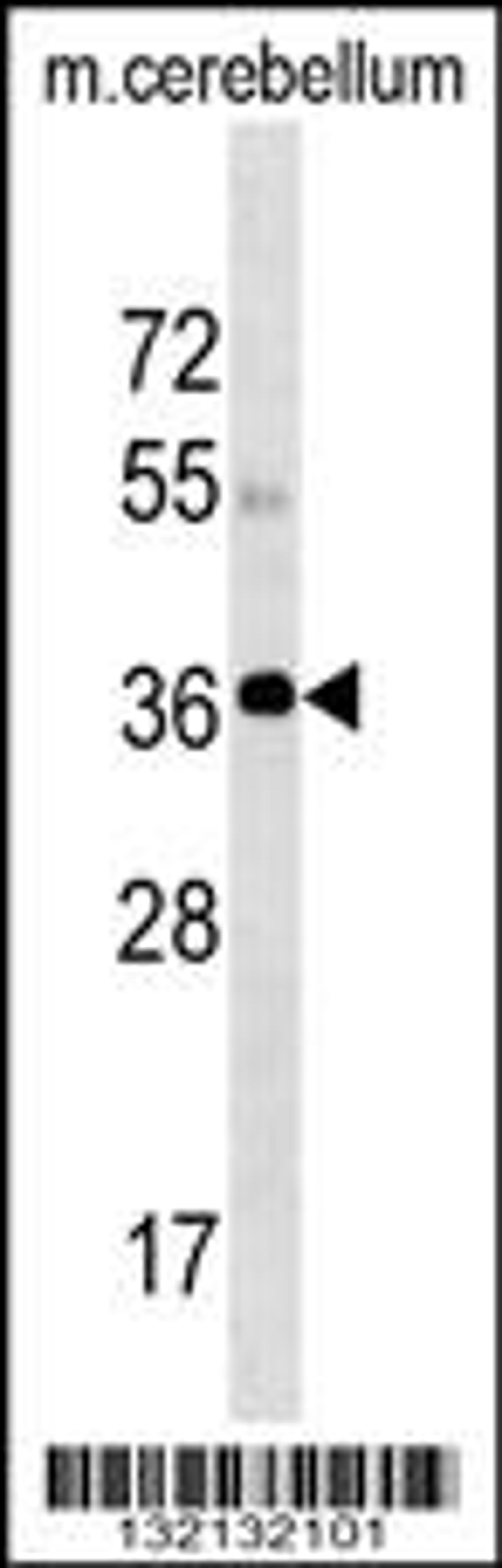 Western blot analysis in mouse cerebellum tissue lysates (35ug/lane).