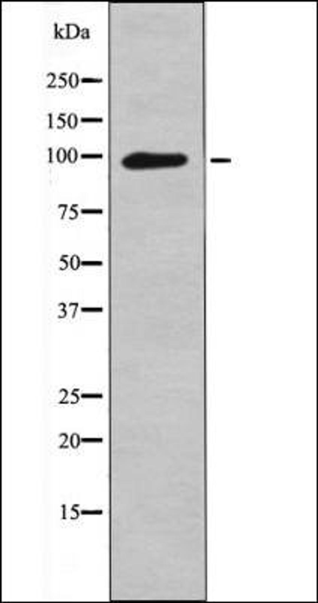 Western blot analysis of PMA treated Jurkat whole cell lysates using Leptin Receptor -Phospho-Tyr1141- antibody