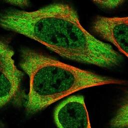 Immunocytochemistry/Immunofluorescence: alpha-Taxilin Antibody [NBP1-91662] - Alpha Taxilin Antibody [NBP1-91662] - Staining of human cell line U-2 OS shows positivity in nucleus but not nucleoli & cytoplasm.