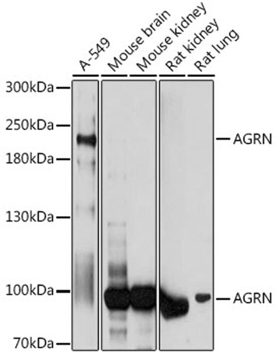 Western blot - AGRN antibody (A17320)