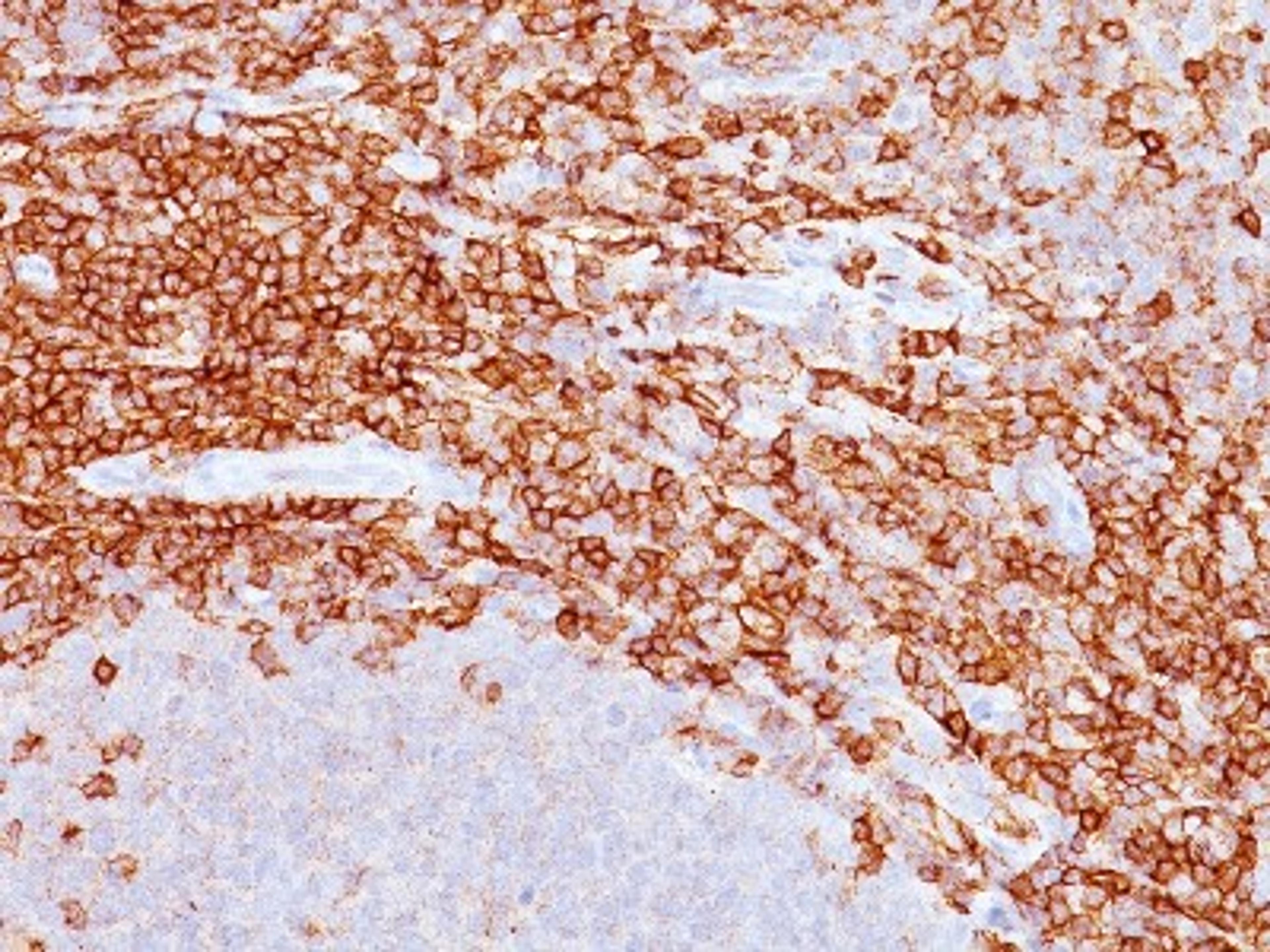 Immunohistochemistry-Paraffin: CD43/Sialophorin Antibody (SPM503) [NBP2-32822] - Formalin-paraffin spleen stained with CD43 MAb (SPM503).