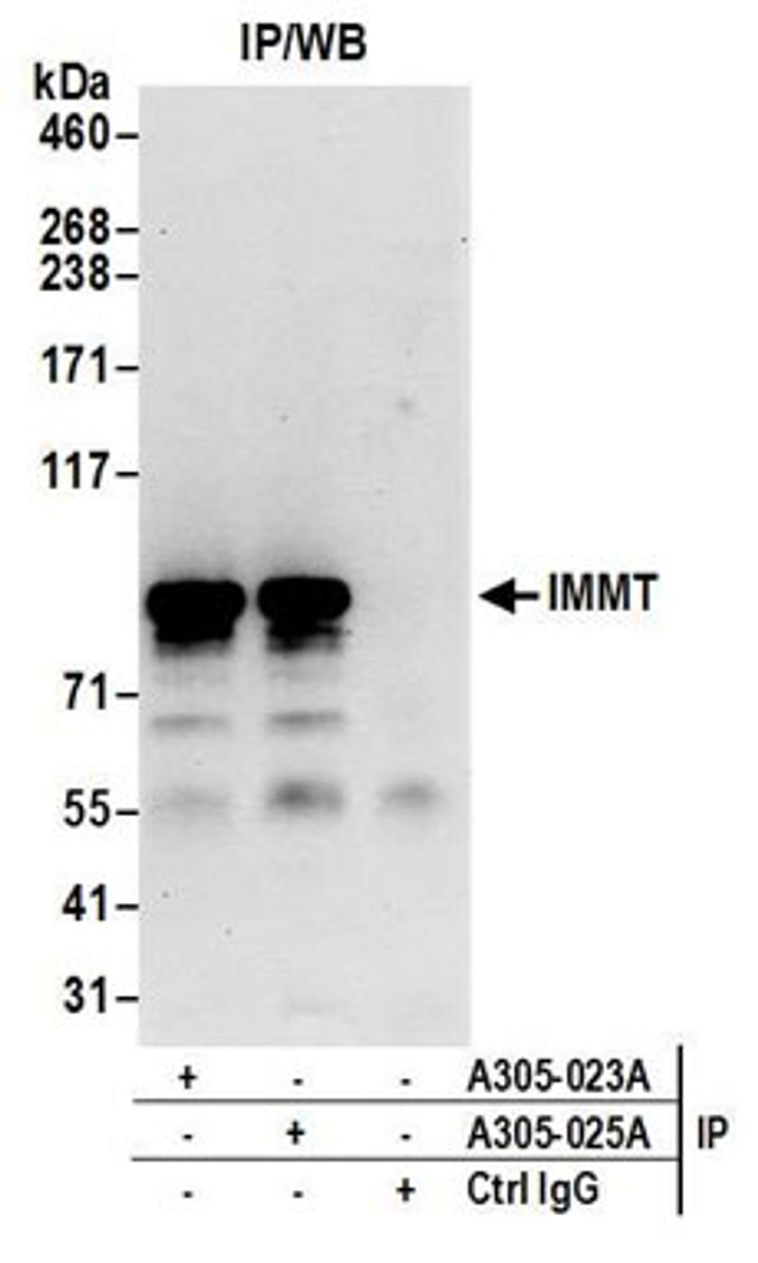 Detection of human IMMT by western blot of immunoprecipitates.