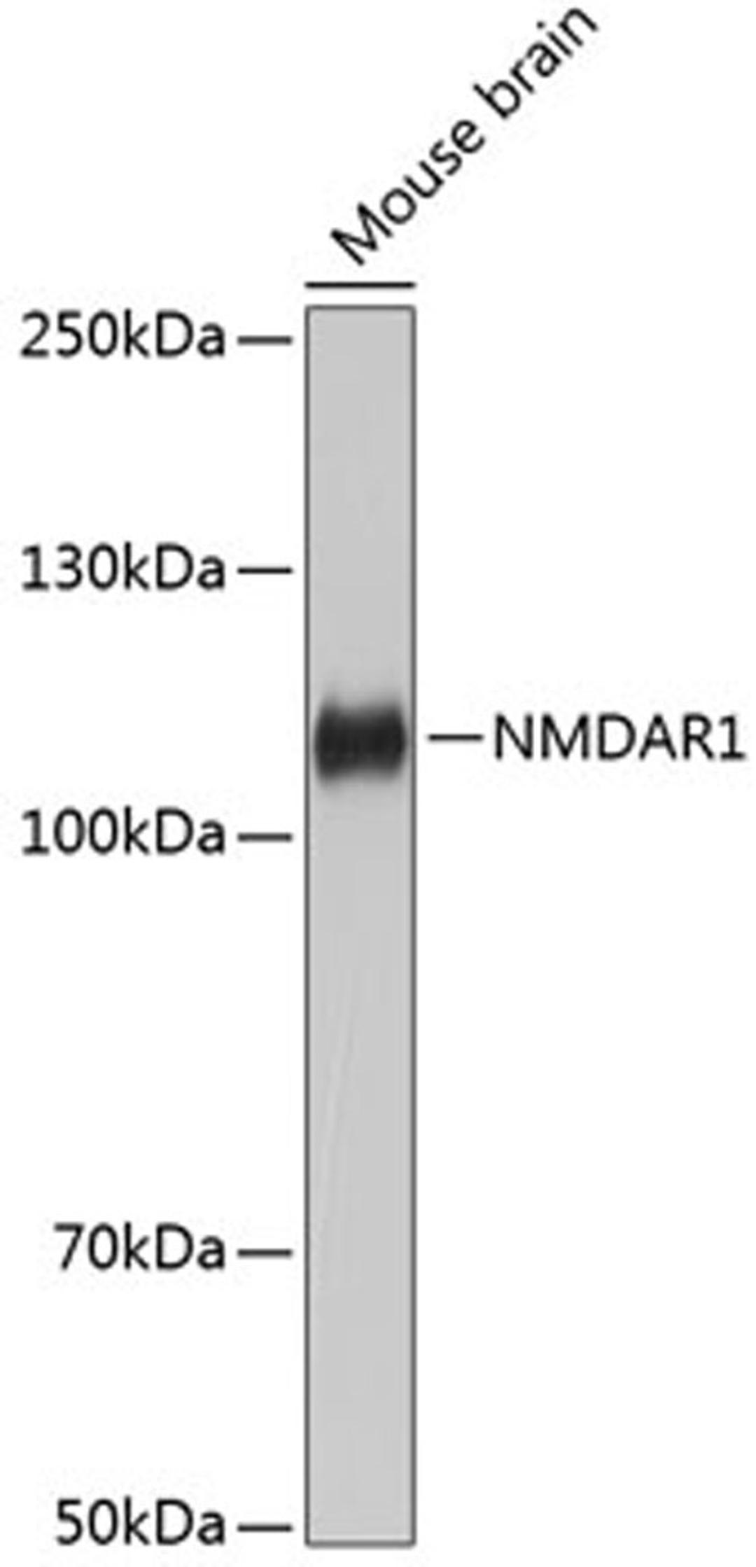 Western blot - NMDAR1 Rabbit mAb (A11699)