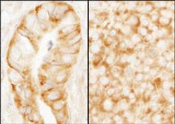 Detection of human and mouse rpL7a (SURF3) by immunohistochemistry.