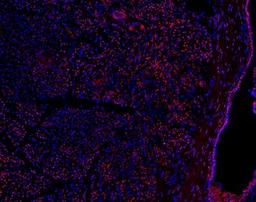 Immunofluorescence: PRICKLE1 Antibody [NBP1-83967] - Human pancreatic frozen tissue sections stained with PRICKLE1 antibody (red). Nuclei labeled with DAPI (blue). Image from verified customer review.