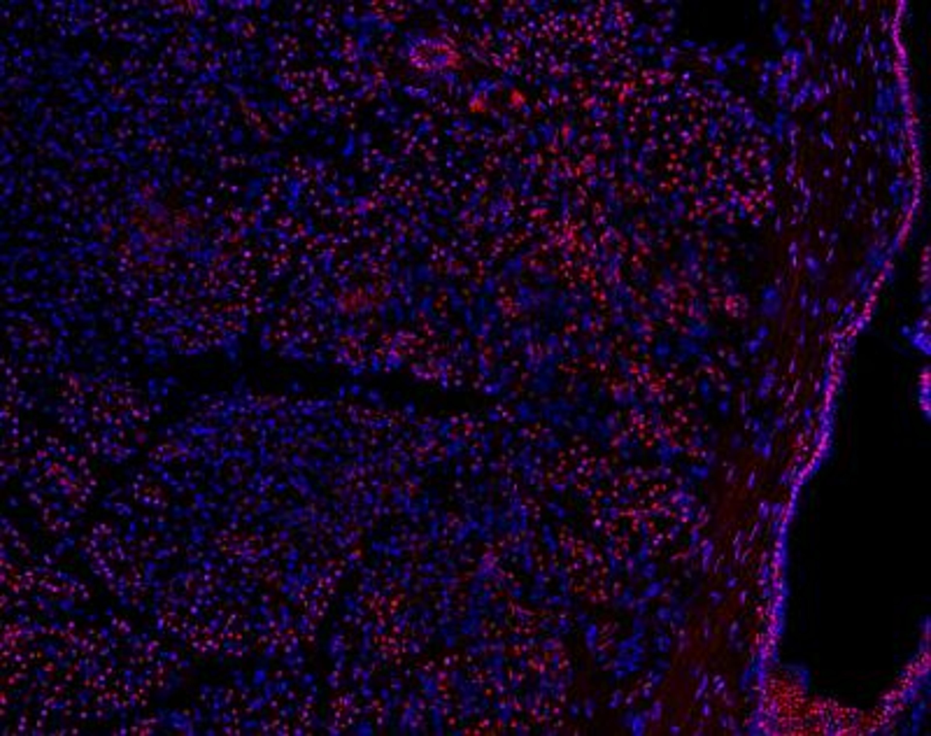 Immunofluorescence: PRICKLE1 Antibody [NBP1-83967] - Human pancreatic frozen tissue sections stained with PRICKLE1 antibody (red). Nuclei labeled with DAPI (blue). Image from verified customer review.