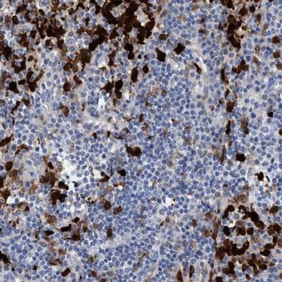 Immunohistochemistry-Paraffin: Indoleamine 2,3-dioxygenase/IDO Antibody [NBP1-87702] - Staining of human lymph node shows strong cytoplasmic and nuclear positivity in lymphoid cells outside reaction centra.