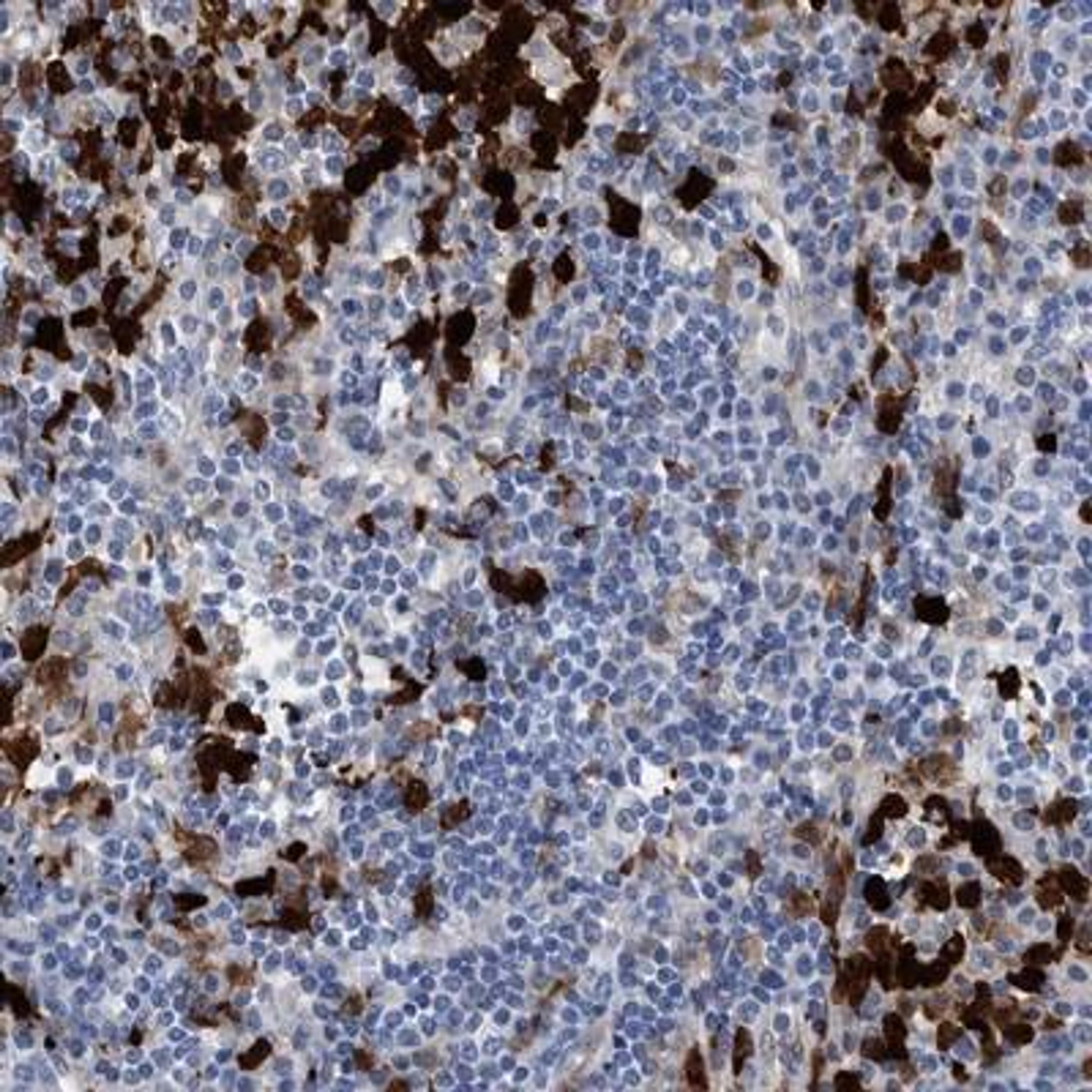 Immunohistochemistry-Paraffin: Indoleamine 2,3-dioxygenase/IDO Antibody [NBP1-87702] - Staining of human lymph node shows strong cytoplasmic and nuclear positivity in lymphoid cells outside reaction centra.