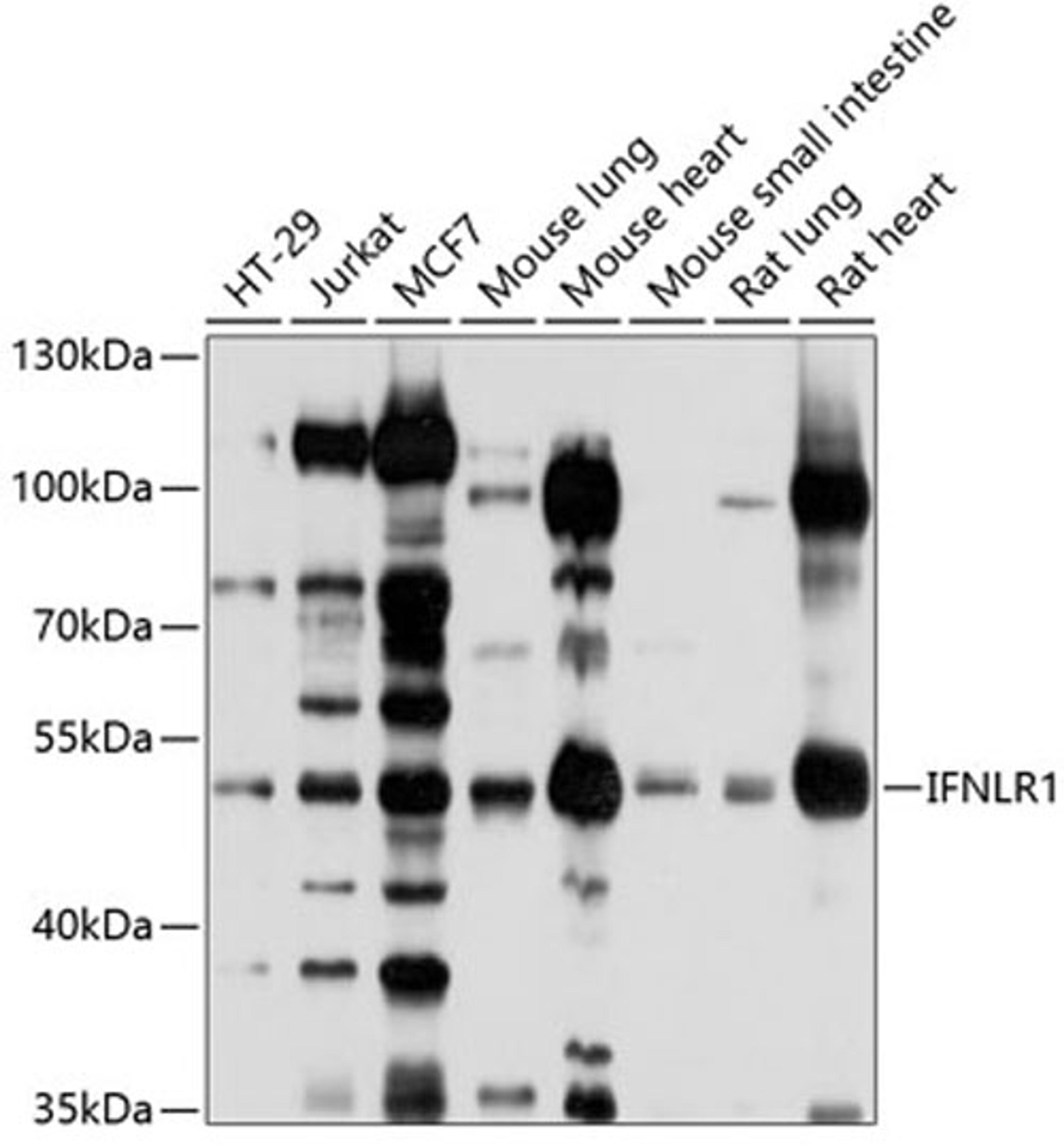 Western blot - IFNLR1 antibody (A10082)