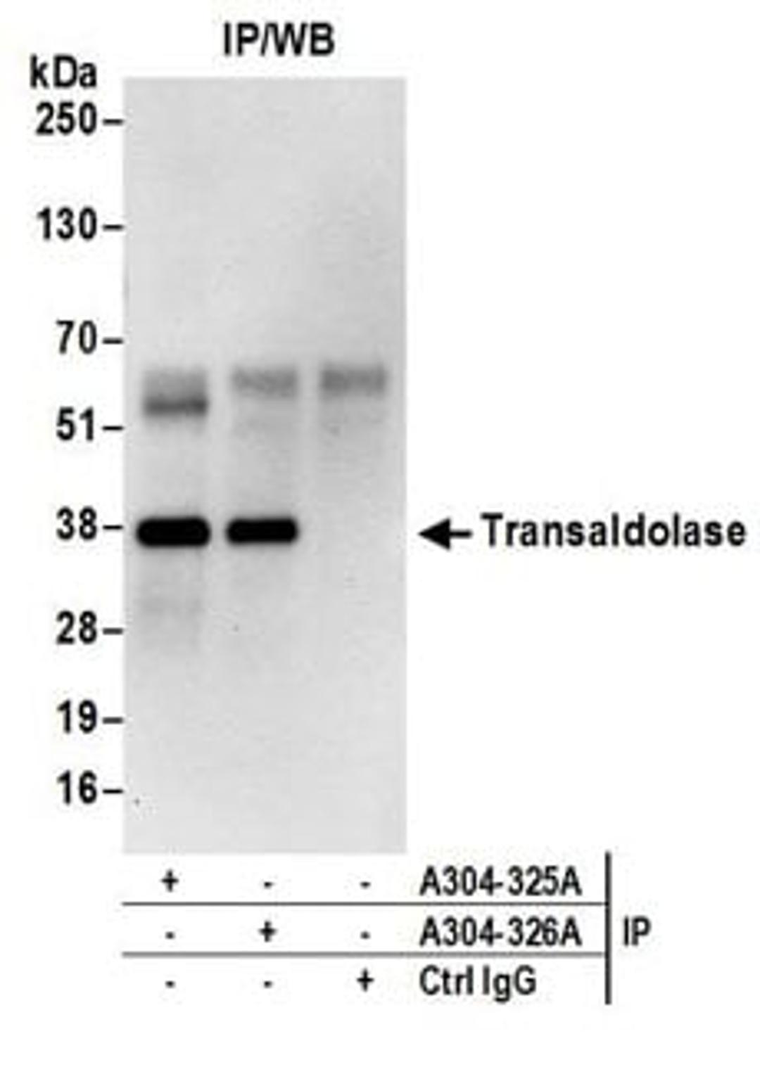 Detection of human Transaldolase by western blot of immunoprecipitates.