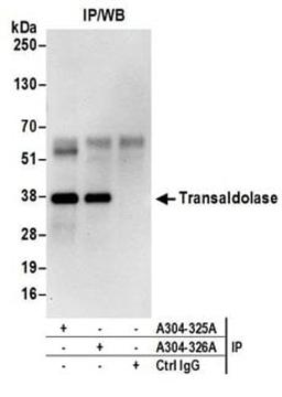 Detection of human Transaldolase by western blot of immunoprecipitates.