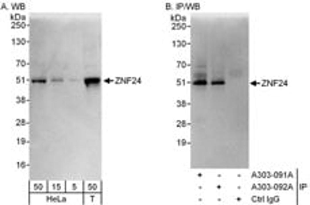 Detection of human ZNF24 by western blot and immunoprecipitation.