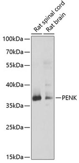 Western blot - PENK antibody (A6302)