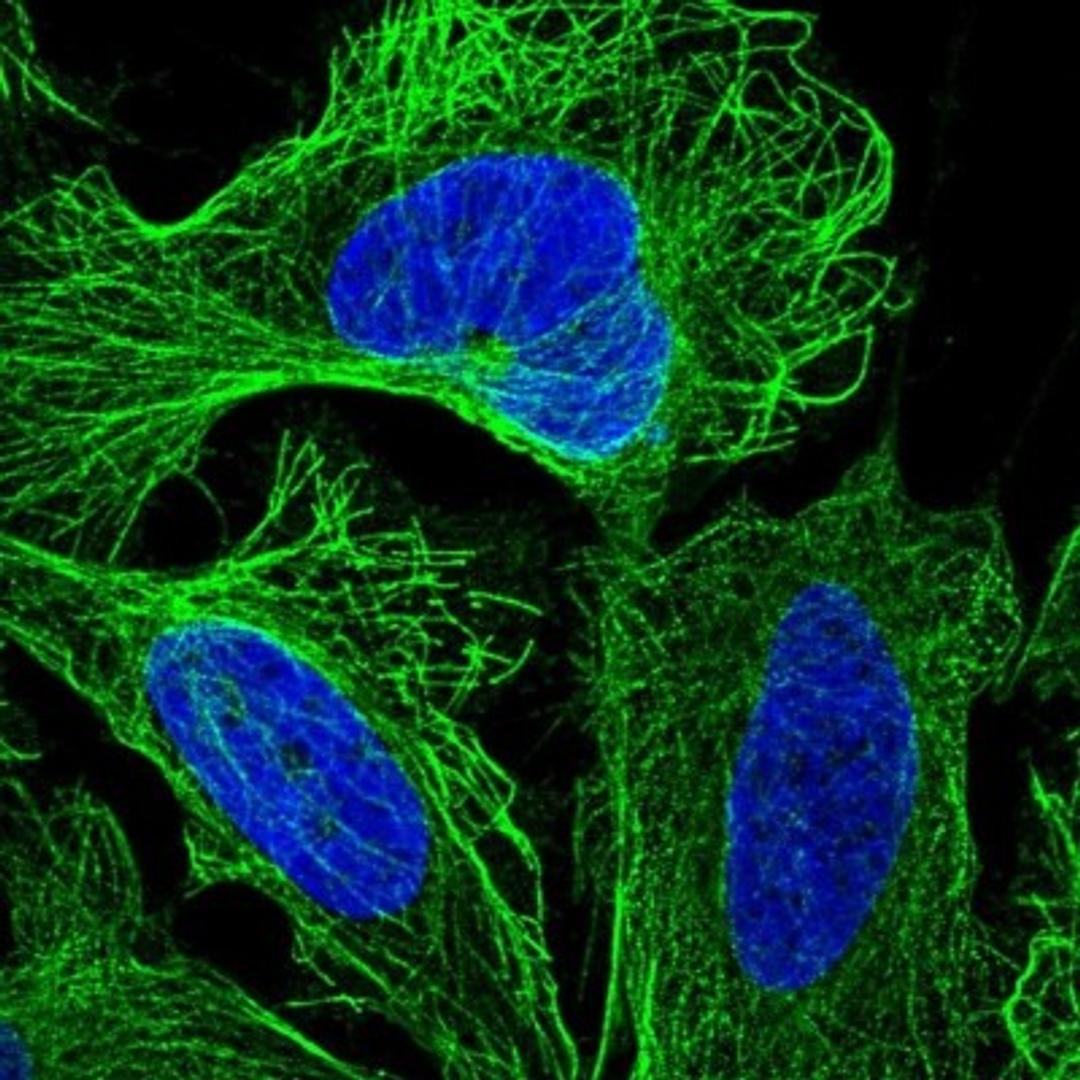 Immunocytochemistry/Immunofluorescence: LEKR1 Antibody [NBP1-93995] - Staining of human cell line U-2 OS shows positivity in cytoskeleton (microtubules).