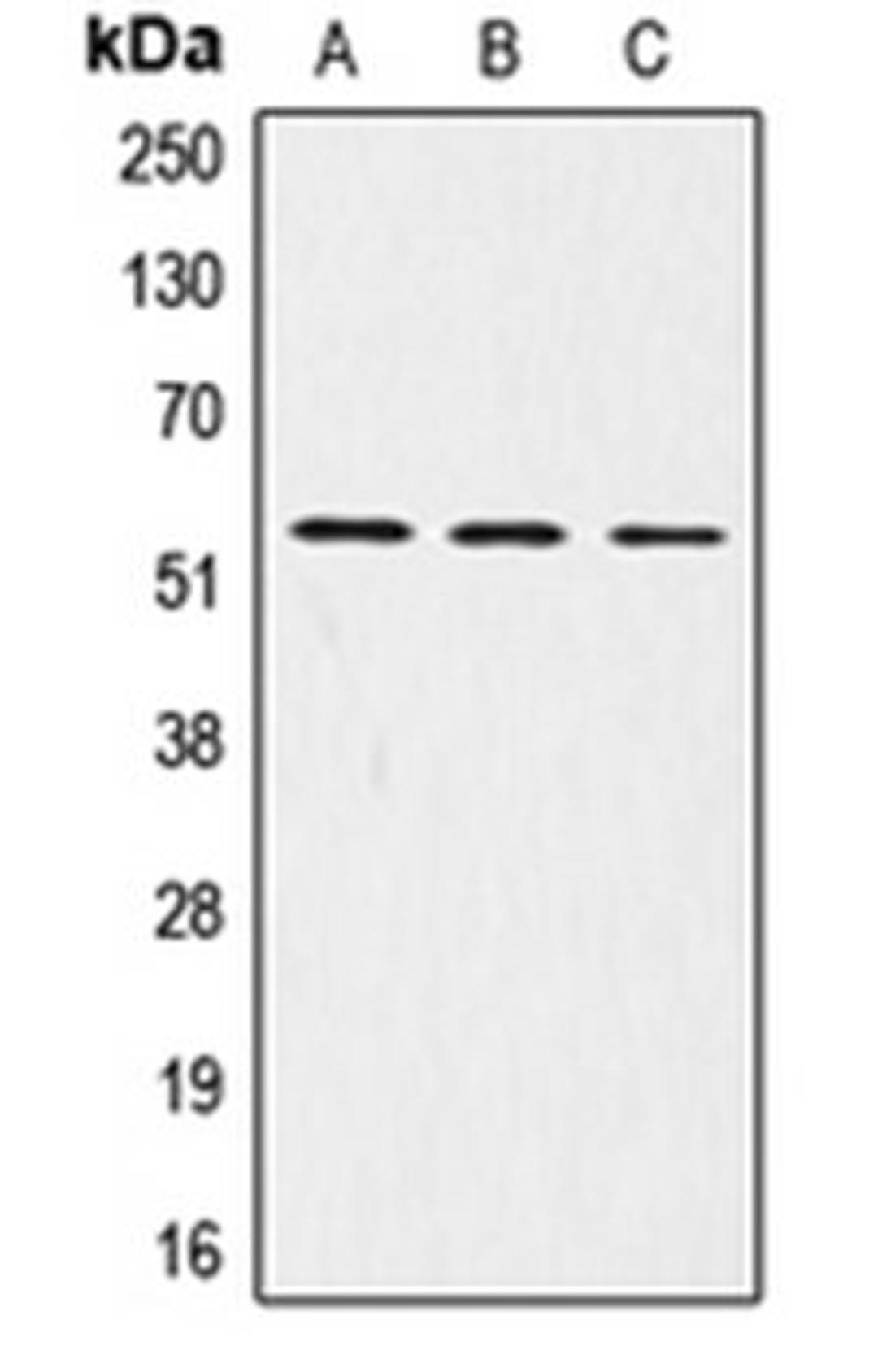 Western blot analysis of A431 (Lane 1), HepG2 (Lane 2), Jurkat (Lane 3) whole cell lysates using LRP11 antibody