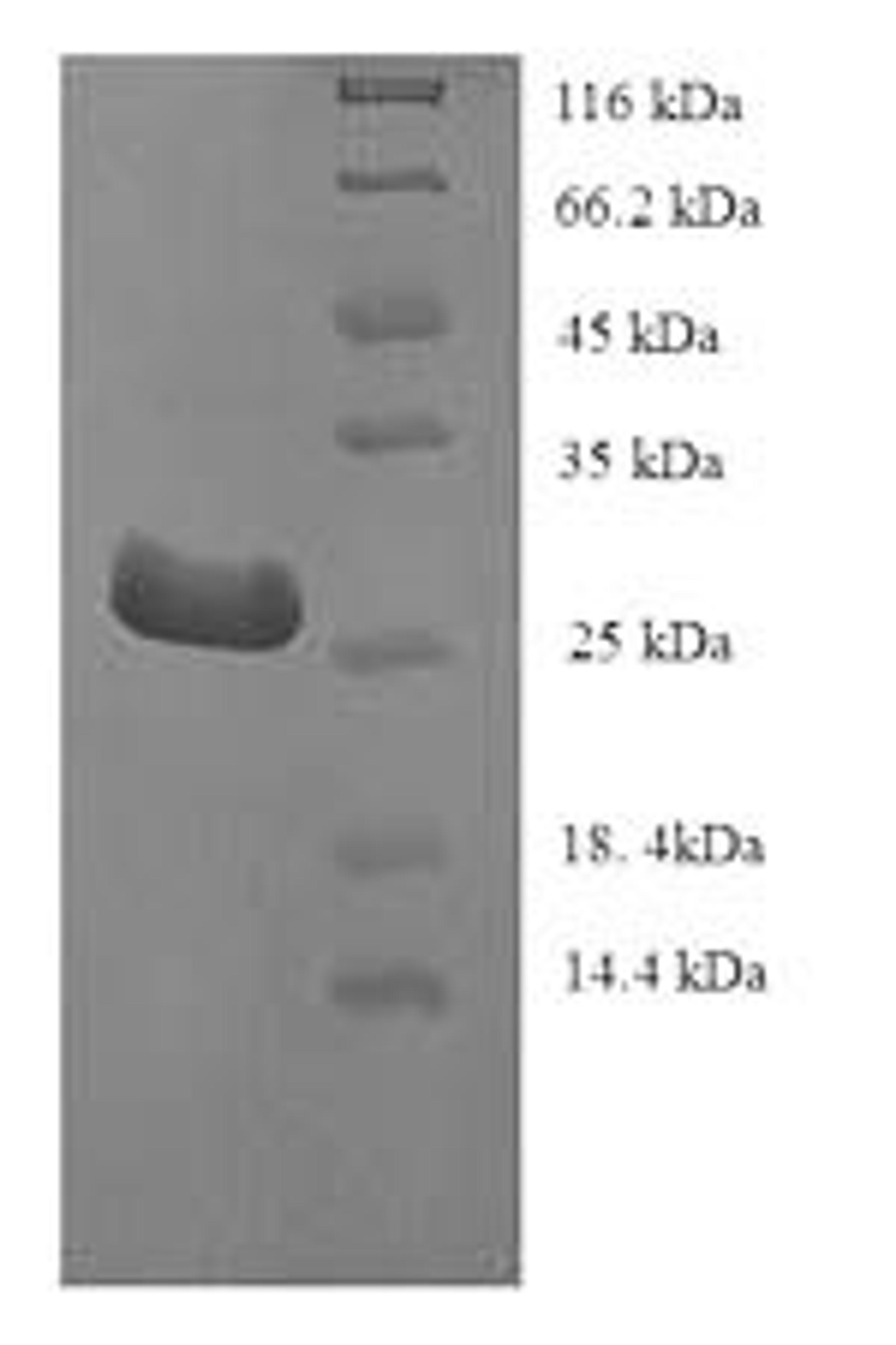 (Tris-Glycine gel) Discontinuous SDS-PAGE (reduced) with 5% enrichment gel and 15% separation gel.