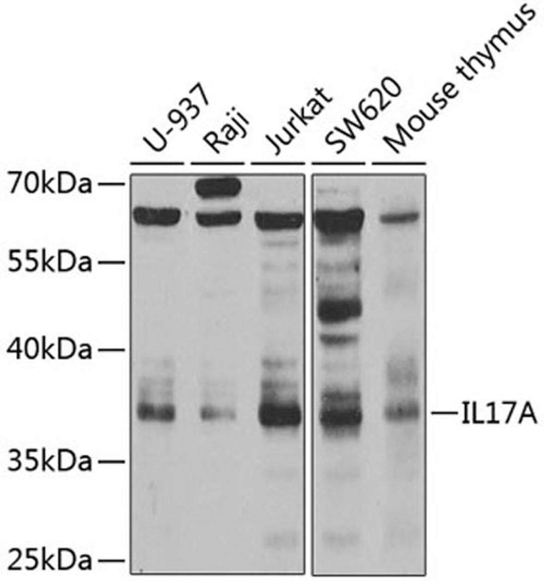 Western blot - IL17A antibody (A12454)