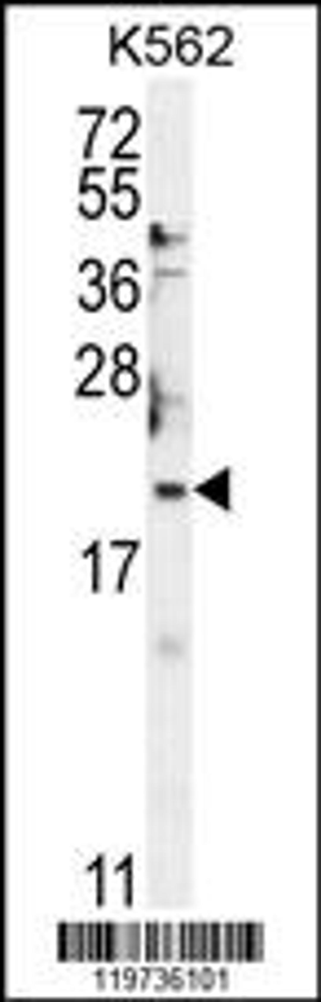 Western blot analysis in K562 cell line lysates (35ug/lane).