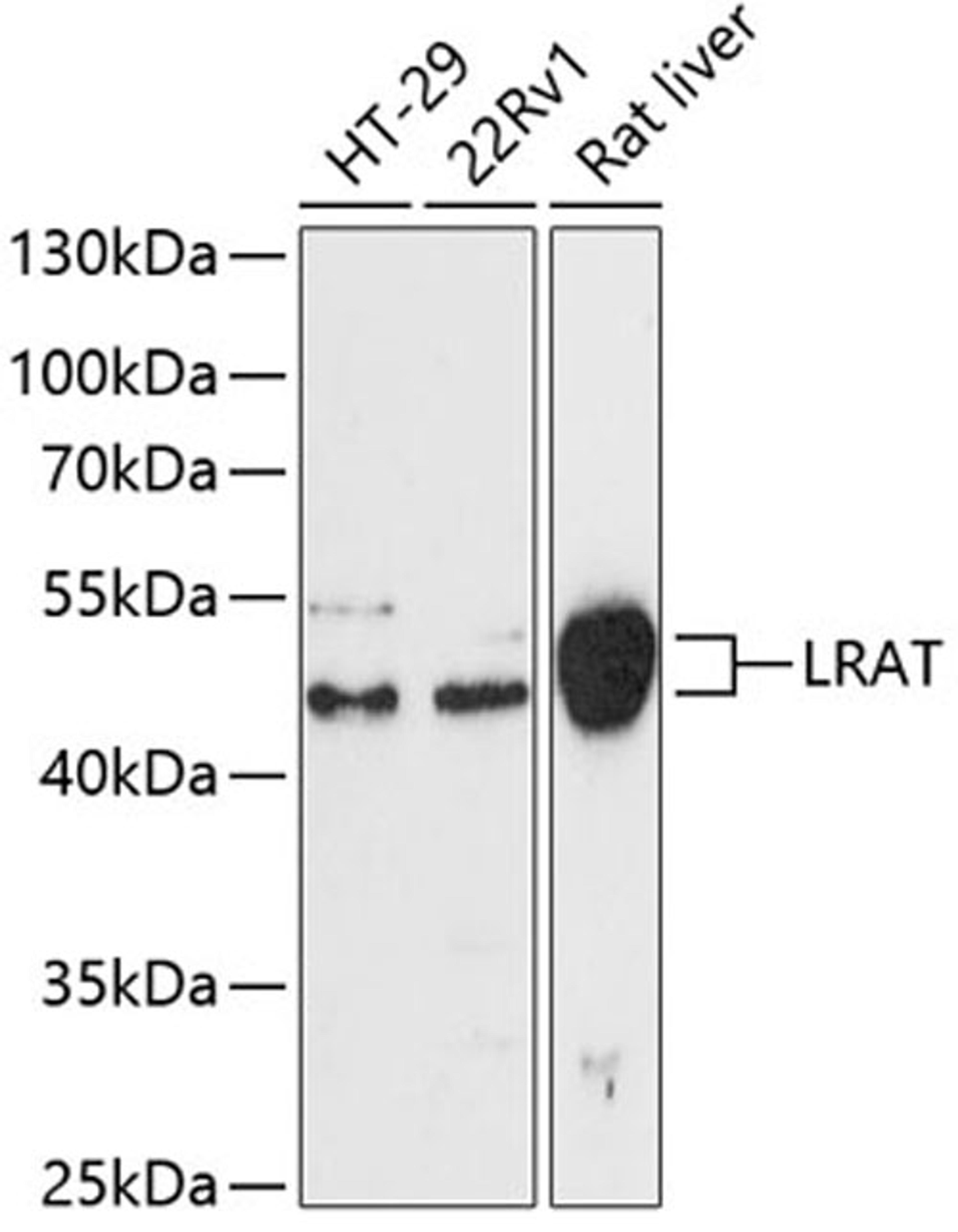 Western blot - Lrat antibody (A13175)