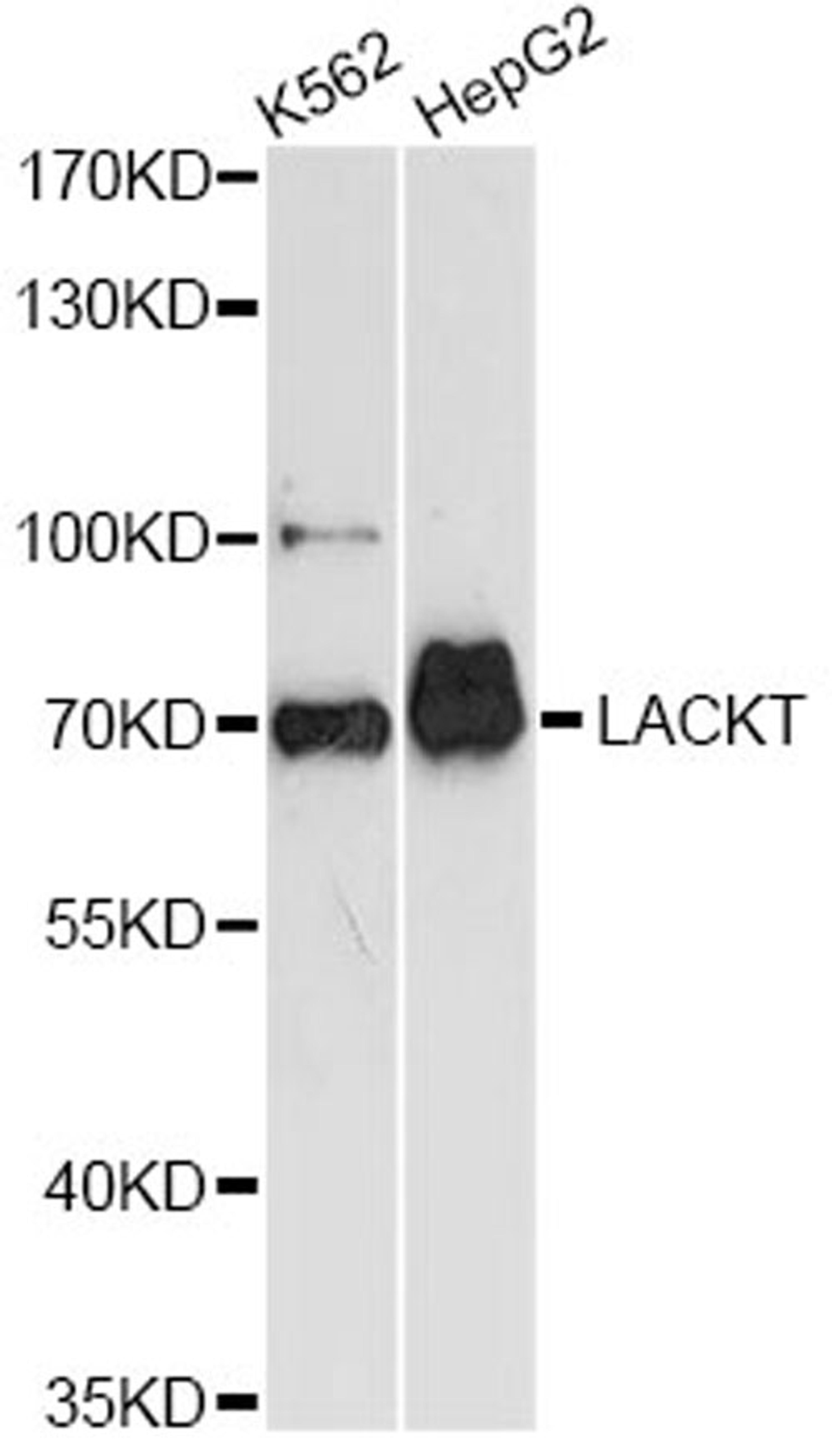 Western blot - ASH2L antibody (A14543)