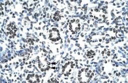 Antibody used in IHC on Human Lung.