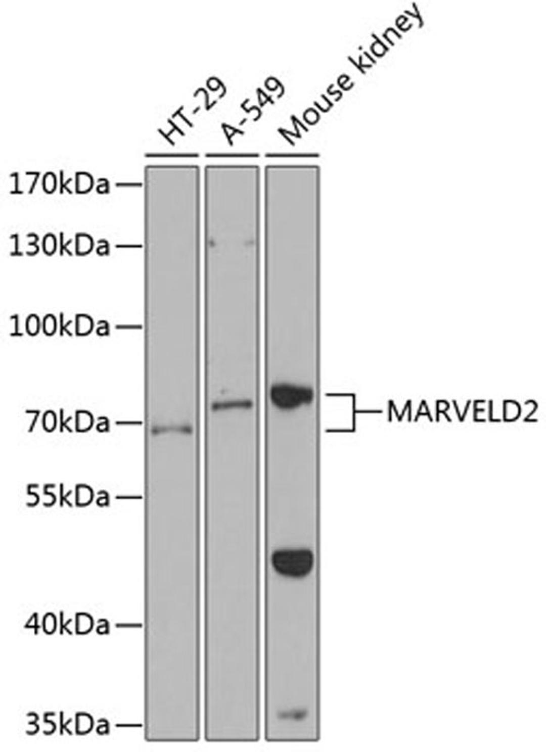 Western blot - MARVELD2 antibody (A12612)