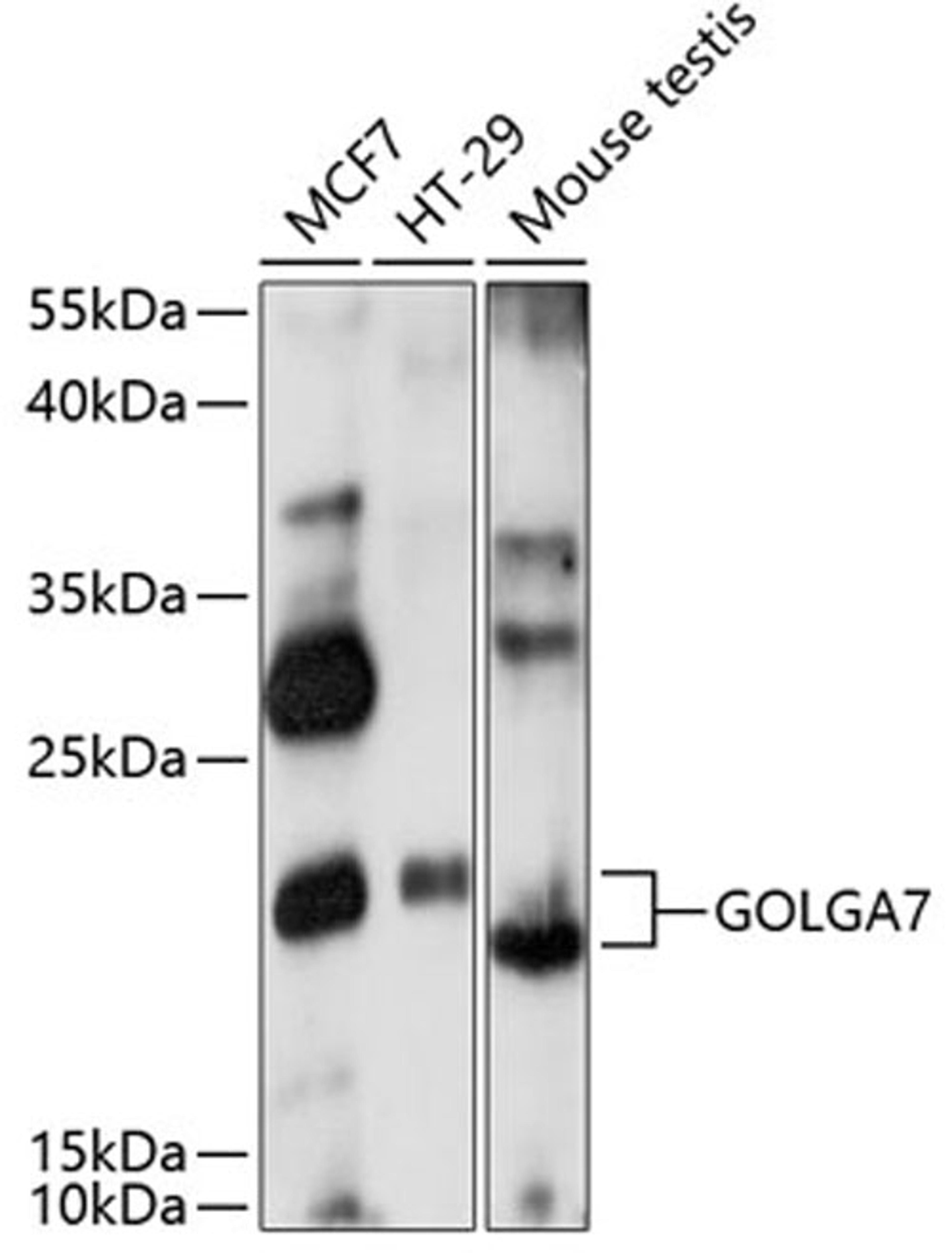 Western blot - GOLGA7 antibody (A14888)