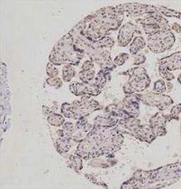 Immunohistochemical staining of human placenta tissue using p38 MAPK (phospho-Thr180-Tyr182) antibody.