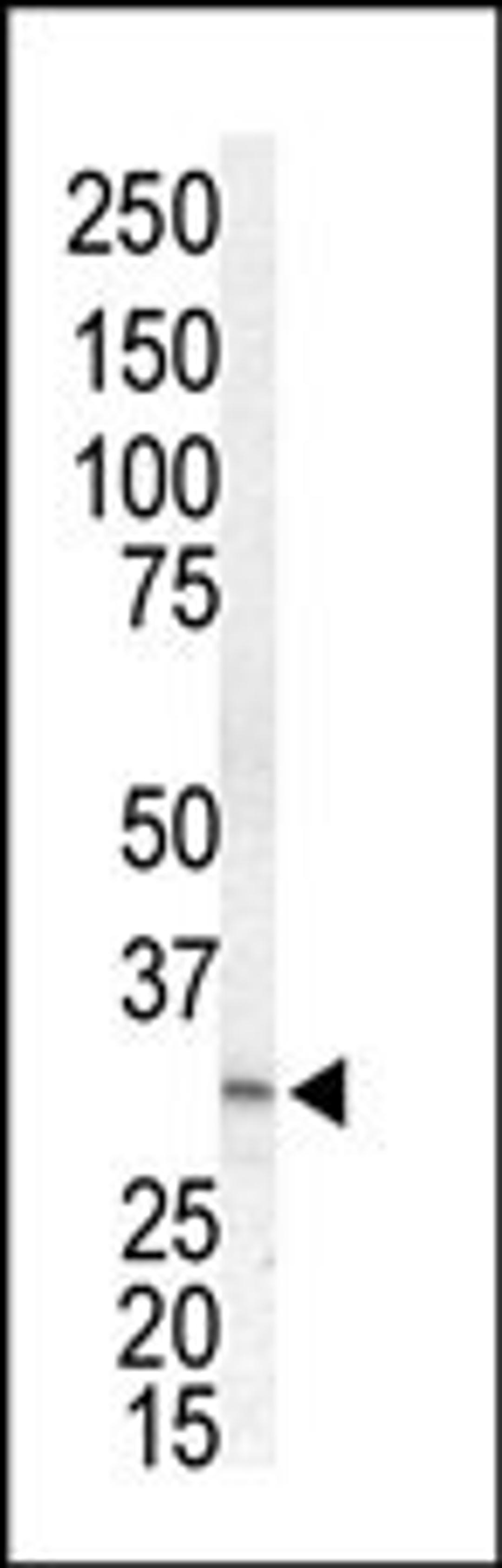 Western blot analysis of anti-MKK3 Pab in Jurkat cell lysate