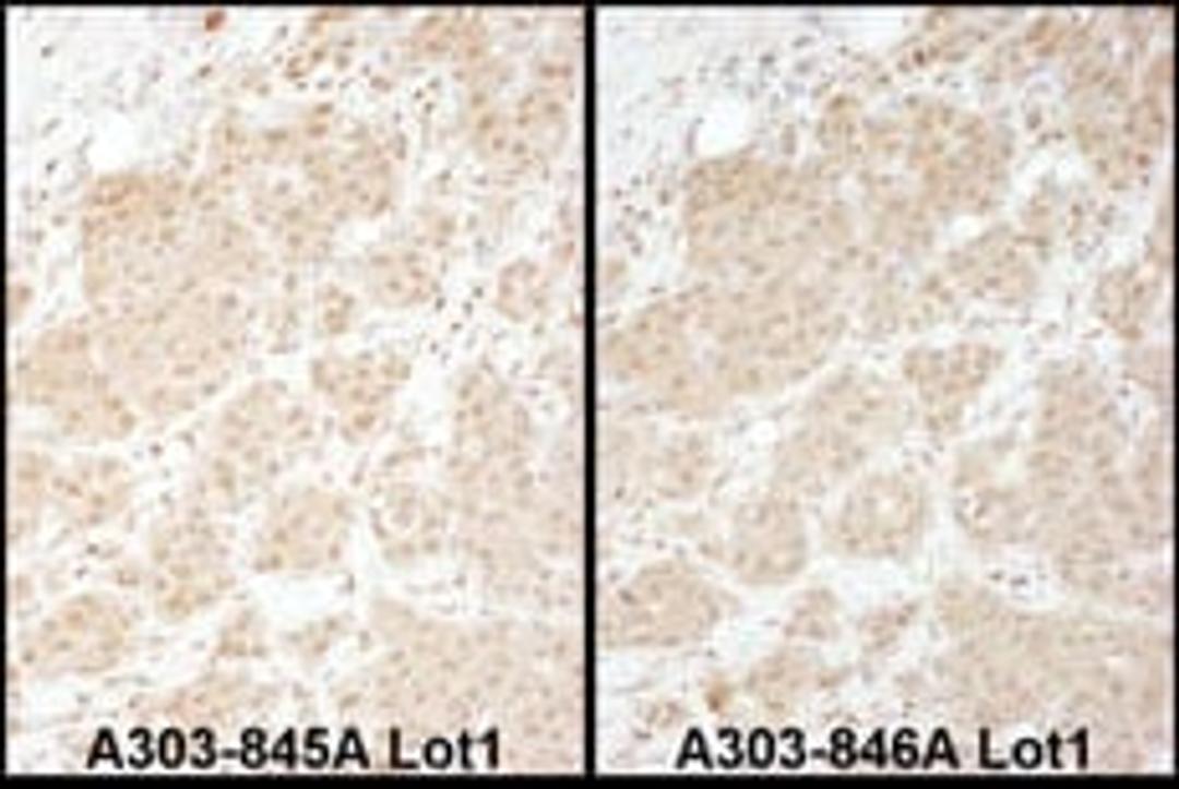 Detection of human PSMA1 by immunohistochemistry.