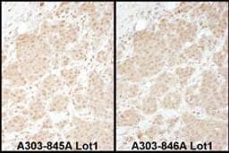 Detection of human PSMA1 by immunohistochemistry.