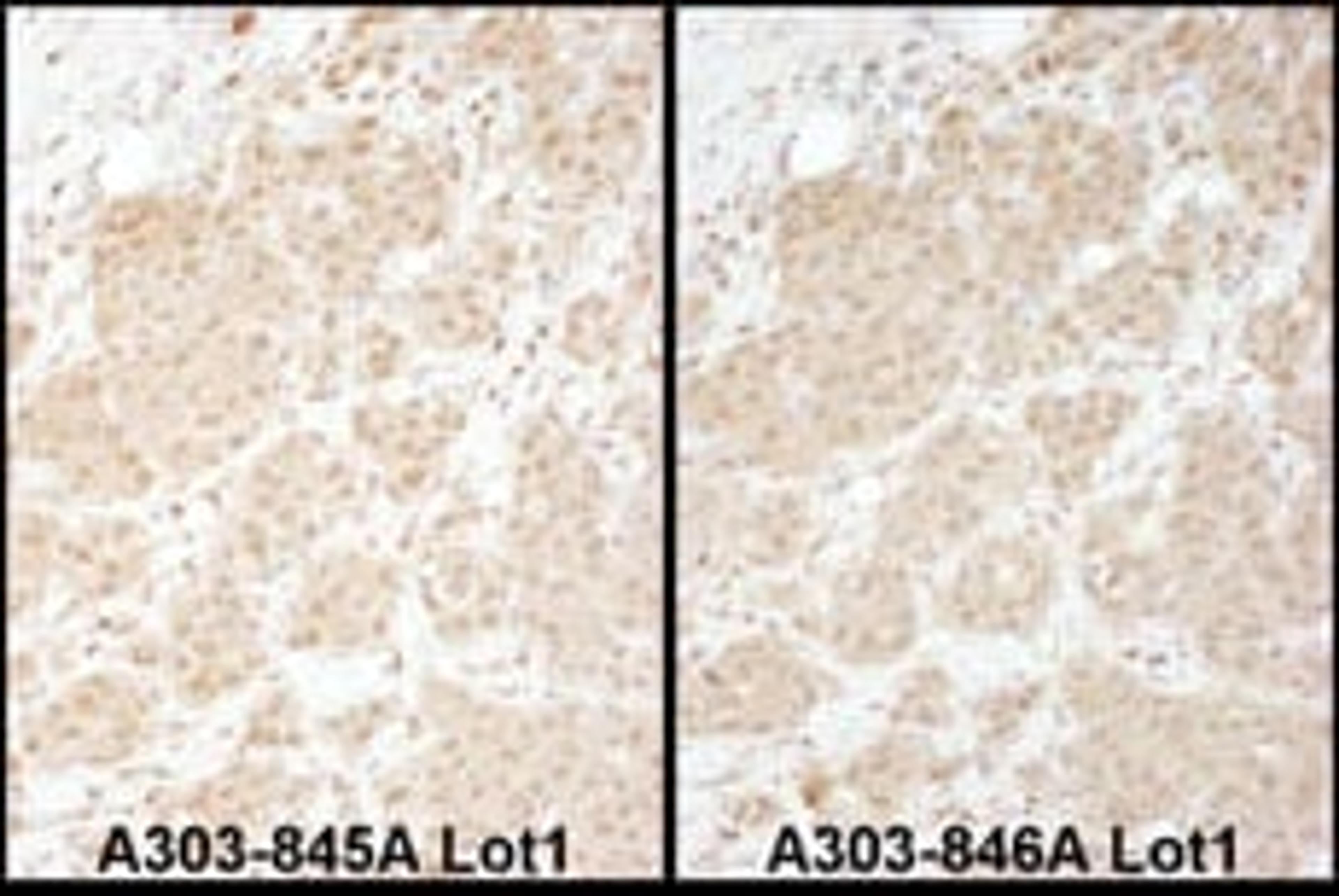 Detection of human PSMA1 by immunohistochemistry.