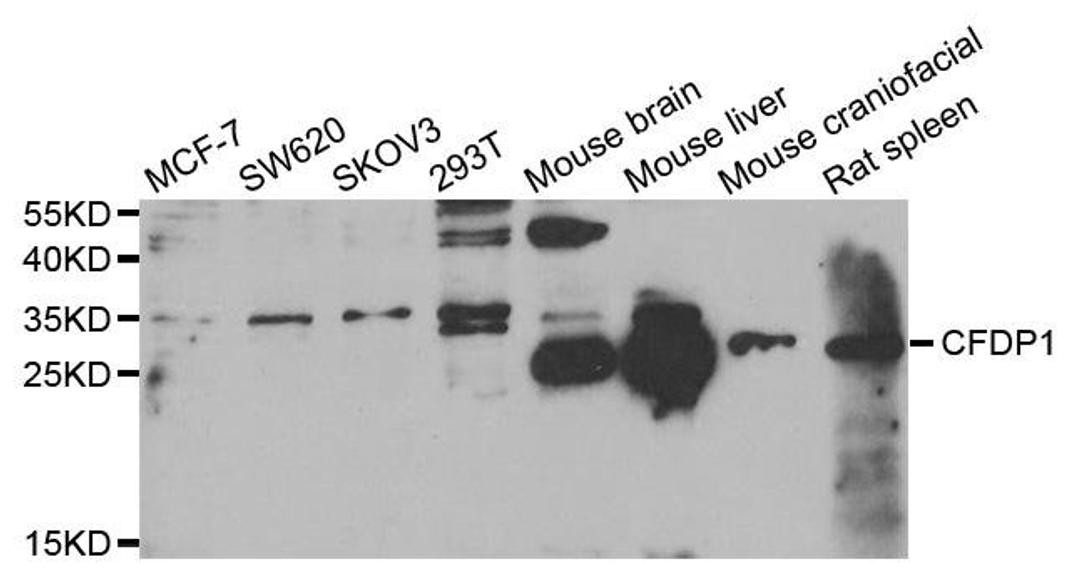 Western blot analysis of extracts of various cell lines using CFDP1 antibody