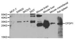 Western blot analysis of extracts of various cell lines using CFDP1 antibody