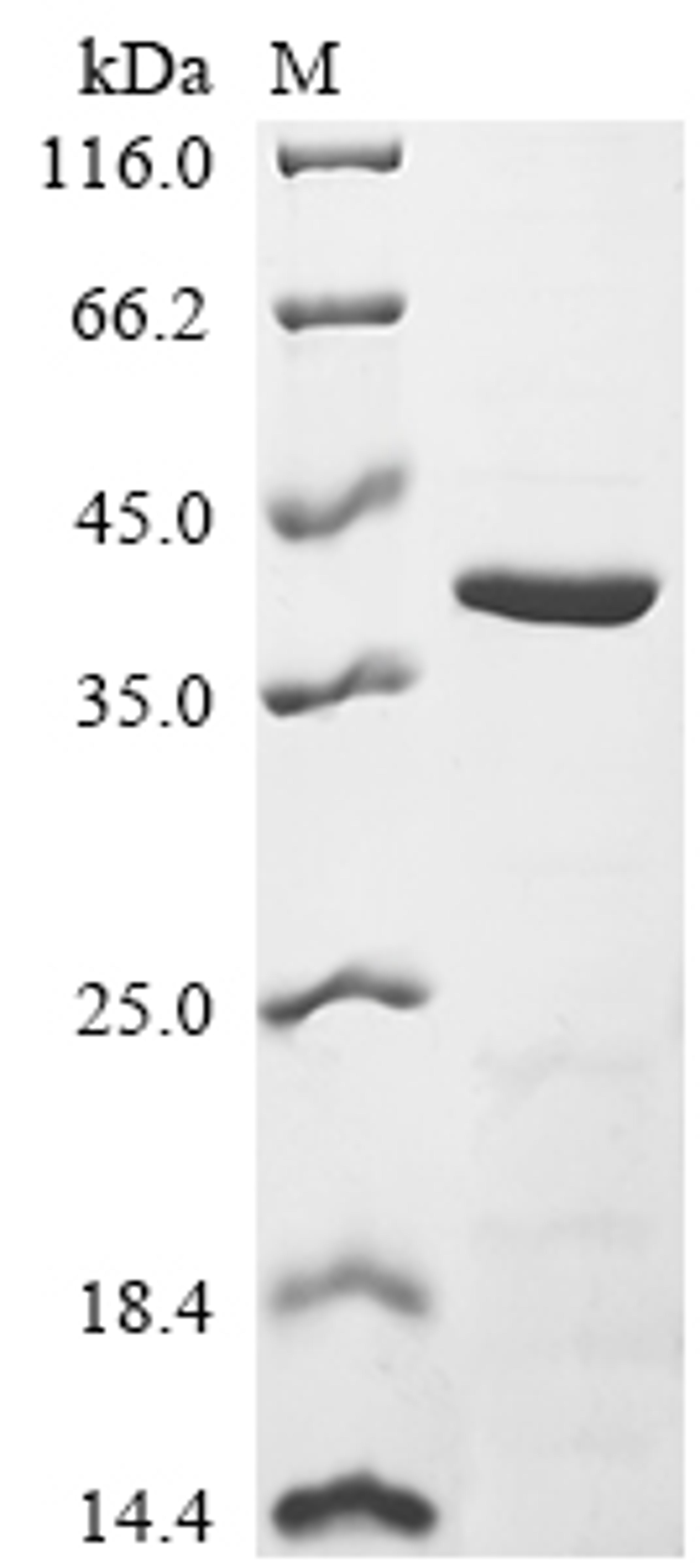 (Tris-Glycine gel) Discontinuous SDS-PAGE (reduced) with 5% enrichment gel and 15% separation gel.