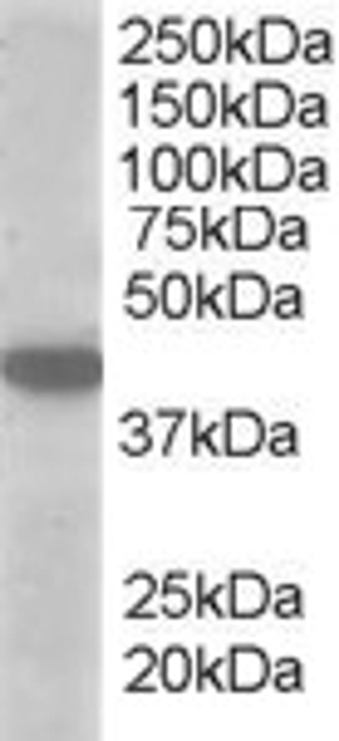 45-873 (1ug/ml) staining of A549 lysate (35ug protein in RIPA buffer). Primary incubation was 1 hour. Detected by chemiluminescence.