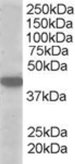 45-873 (1ug/ml) staining of A549 lysate (35ug protein in RIPA buffer). Primary incubation was 1 hour. Detected by chemiluminescence.