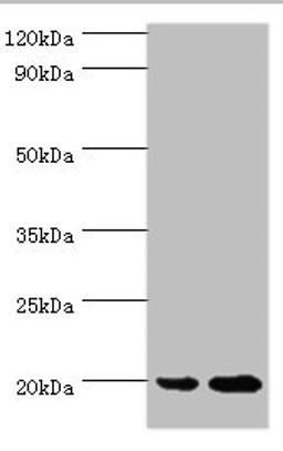 Western blot. All lanes: ARF6 antibody at 2ug/ml. Lane 1: 293T whole cell lysate. Lane 2: HepG2 whole cell lysate. Secondary. Goat polyclonal to rabbit IgG at 1/10000 dilution. Predicted band size: 20 kDa. Observed band size: 20 kDa. 
