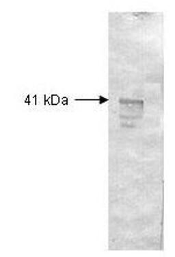 Western blot analysis of enzyme in cellular extracts using Dextranase antibody