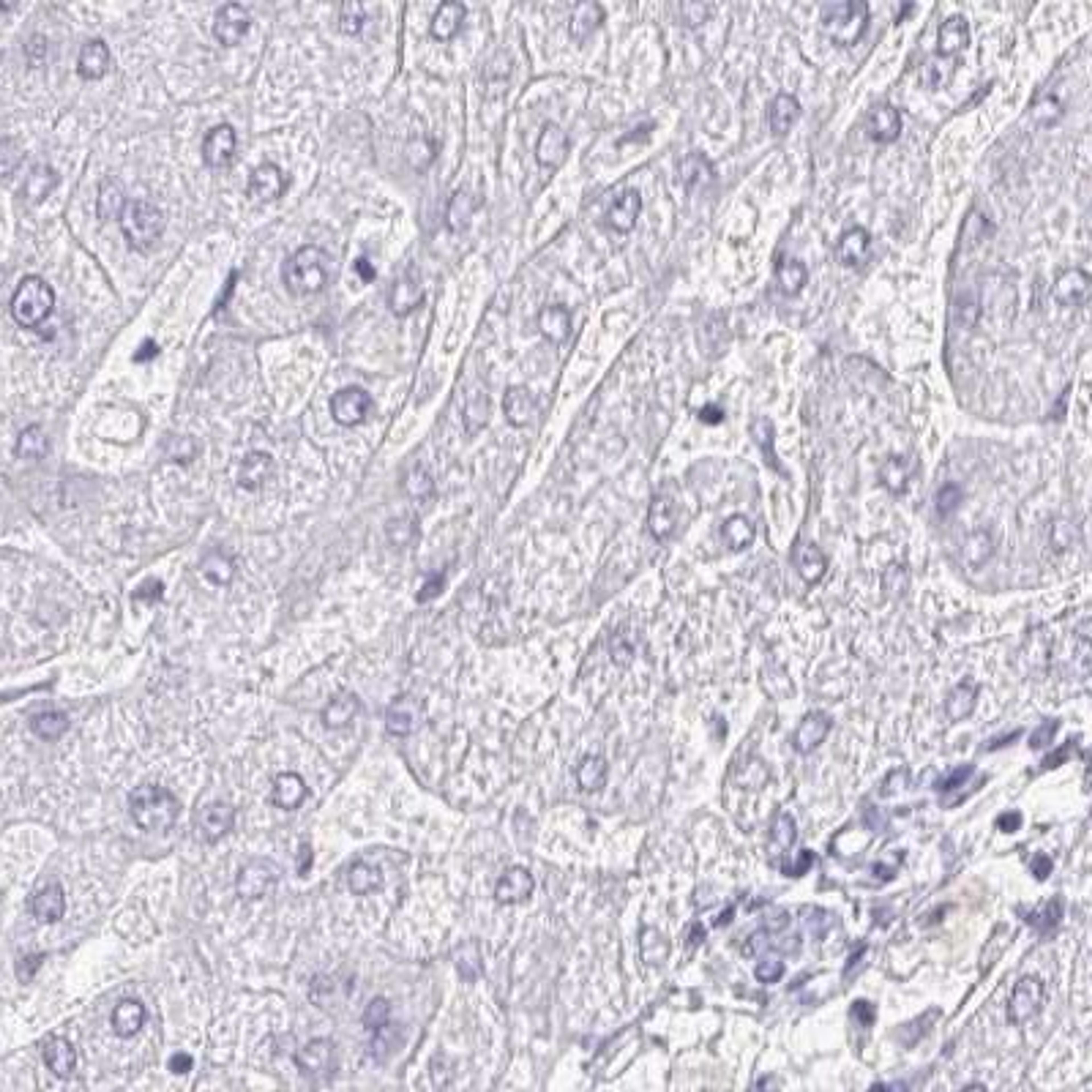 Immunohistochemistry: Doppel Antibody [NBP2-31928] - Immunohistochemical staining of human testis shows strong cytoplasmic and membranous positivity in cells in seminiferus ducts.