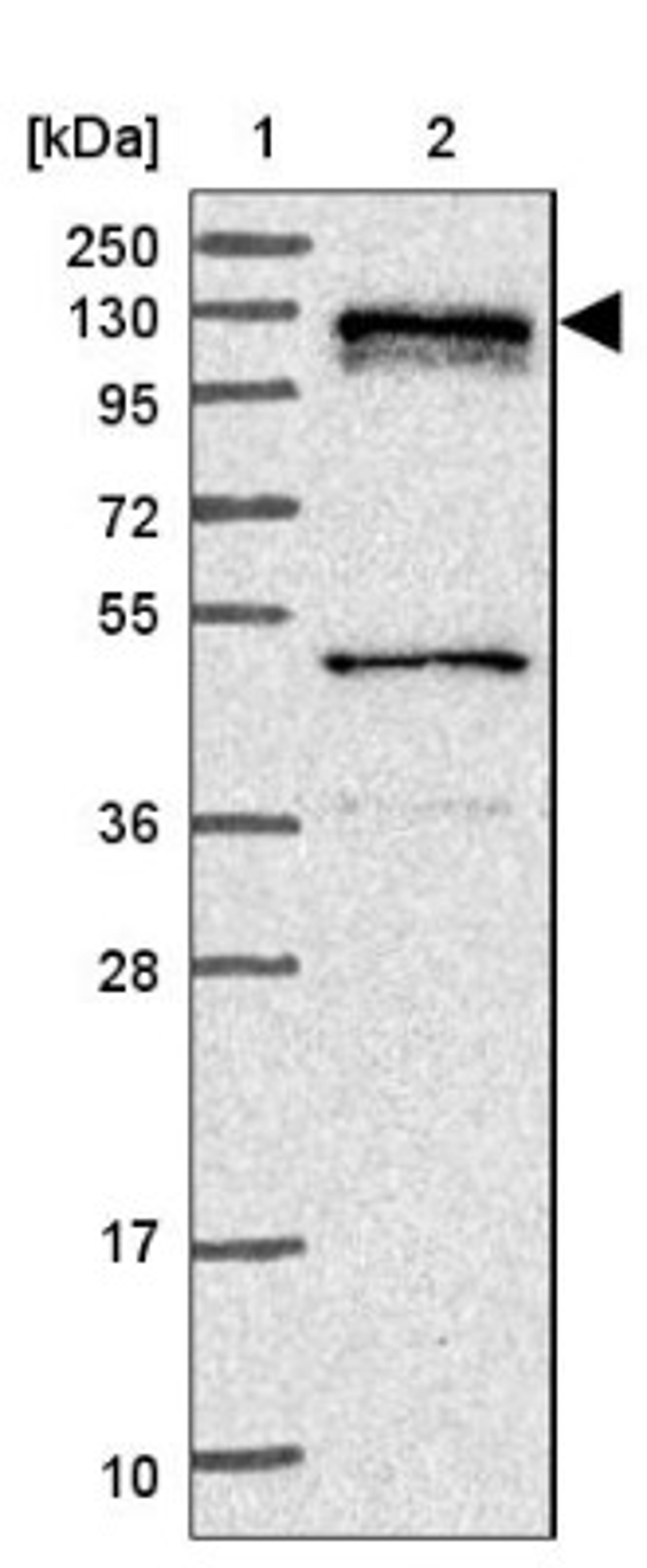 Western Blot: DGKZ Antibody [NBP2-13918] - Lane 1: Marker [kDa] 250, 130, 95, 72, 55, 36, 28, 17, 10<br/>Lane 2: Human cell line RT-4